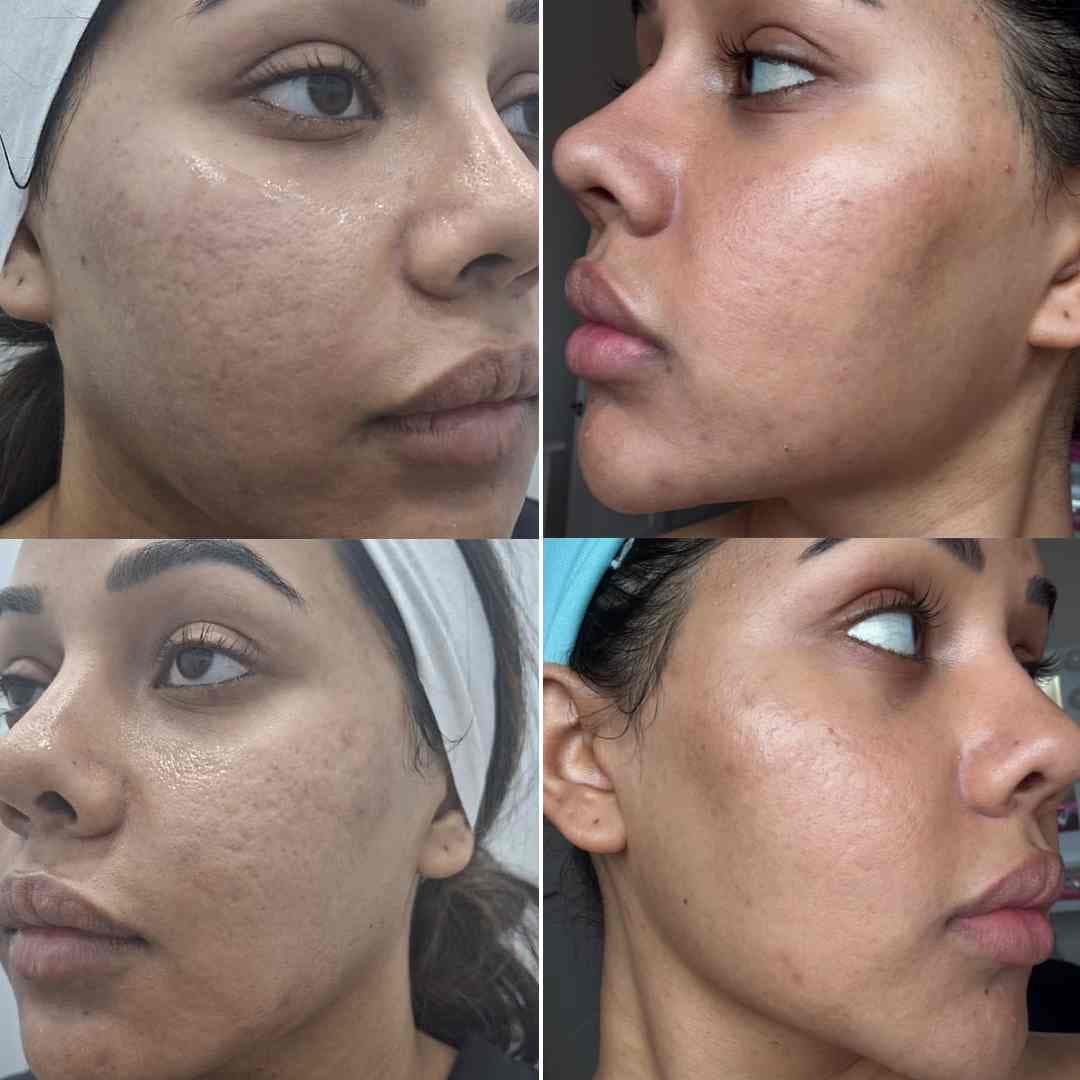 Pigmentation Disorder.jpg