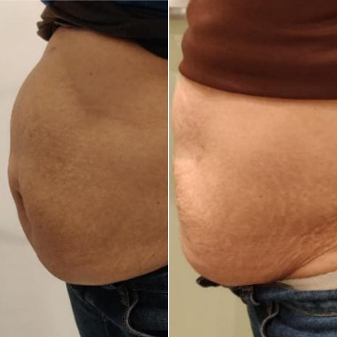 Waight Management.jpg