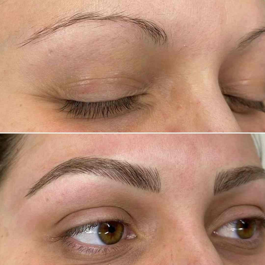 Micropigmentation Scalp Ibrow.jpg.jpg